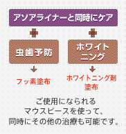 ご使用になられるマウスピースを使って、同時にその他の治療も可能です。