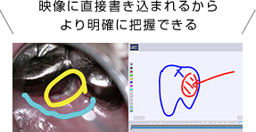 映像に直接書き込まれるからより明確に把握できる