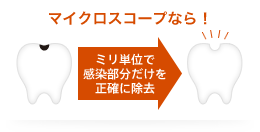 マイクロスコープなら！ミリ単位で感染部分だけを正確に除去